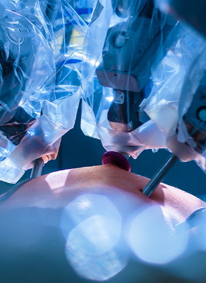 Advanced Laser Anal Fistula Surgery (FiLaC) at IIGU Hospitals Bangalore